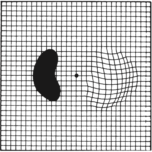 grille d'Amsler